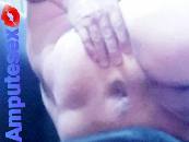 Amputesex amputato real sex.
